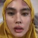 Kartika Putri Idap Penyakit Autoimun 8 Kartika Putri Idap Penyakit Autoimun