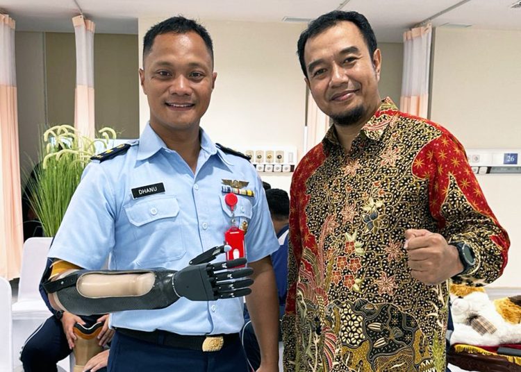 Tangan Bionik Undip Diapresiasi Menteri Pertahanan