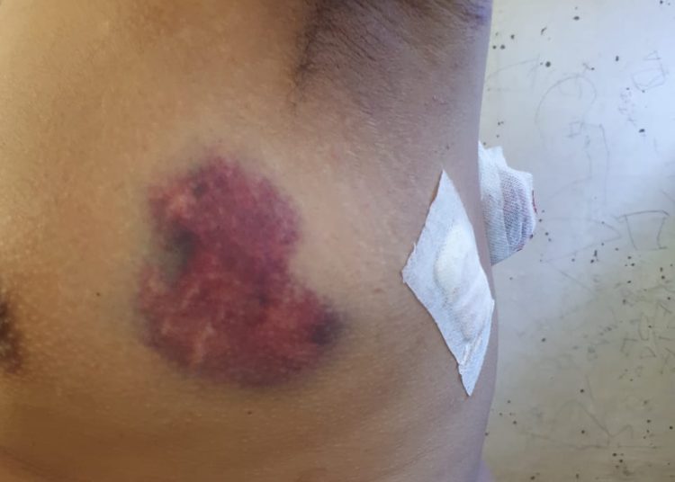 Cegah murid minum pil Aceh, Guru Madrasah Aliyah Di Bacok, Nizar minta Aparat usut tuntas