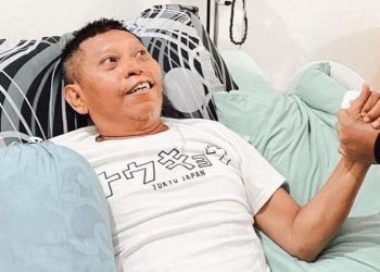Pasca Pendarahan Otak, Ini Kondisi Terkini Tukul Arwana