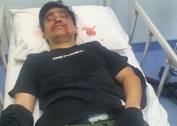 Konten Kreator Medan Wandawandow Kecelakaan, Begini Kondisinya