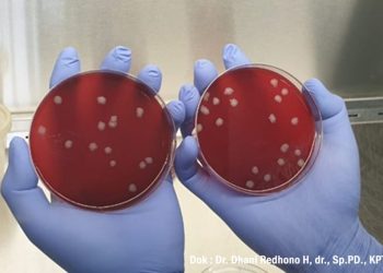 Pakar Kesehatan FK UNS Himbau Masyarakat untuk Mewaspadai Penyakit Antraks – Universitas Sebelas Maret