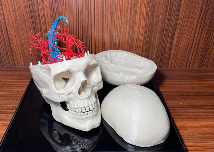 Mahasiswa UDINUS Kembangkan AI untuk Deteksi Pembuluh Darah Otak